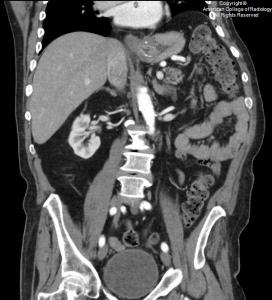 Home | American College of Radiology